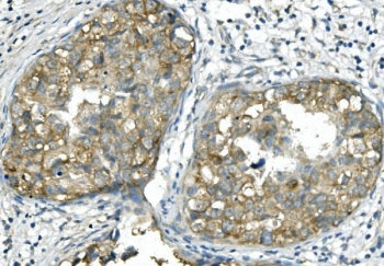 BUB1B Antibody / BubR1