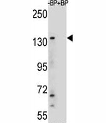 JMJD3 Antibody