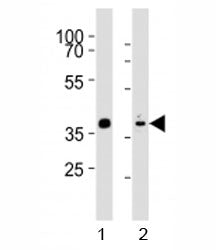 Nkx2.5 Antibody