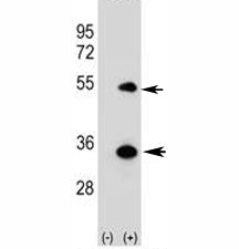 Western blot analysis of ATG5 antibody and 293 cell lysate (2 ug/lane) either nontransfected (Lane 1