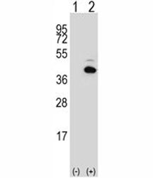 Western blot analysis of PITX1 antibody and 293 cell lysate either nontransfected (Lane 1) or transi