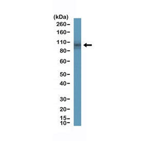 Western blot testing of human small intestine tissue with recombinant DOG1 antibody at 1:200 dilutio