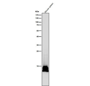 All lanes use the Histone H2B (formyl K116) antibody at 1:5K dilution for 1 hour at room temperature
