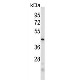 Western blot testing of human MDA-MB-231 cell lysate with PRB2 antibody. Predicted molecular weight 