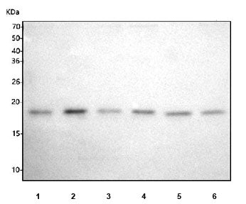 Western blot testing of 1) human 293T, 2) human MCF7, 3) human HT-1080, 4) human HeLa, 5) rat thymus