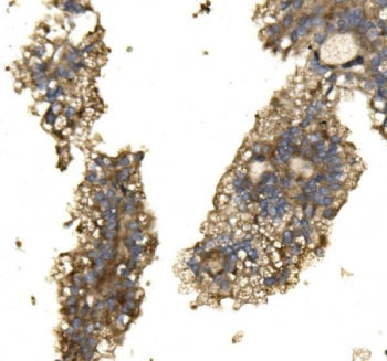 Arginase 2 Antibody