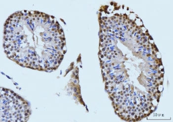 SBNO1 Antibody / MOP-3