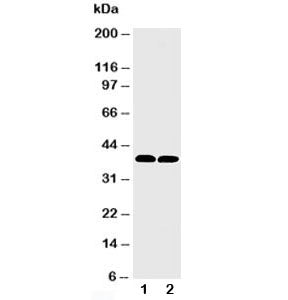 Western blot testing of MTCO1 antibody and Lane 1: rat heart; 2: mouse heart tissue lysate. Predicte
