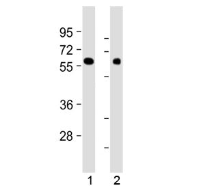 Western blot testing of human 1) kidney and 2) lung tissue lysate with MKS1 antibody at 1:2000. Pred