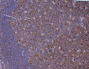 KIF11 Antibody / Eg5