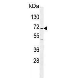 Western blot testing of human Jurkat cell lysate with GAD2 antibody. Predicted molecular weight ~65 