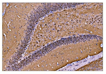 IHC staining of FFPE rat brain tissue with CAMKIV antibody. HIER: boil tissue sections in pH8 EDTA f