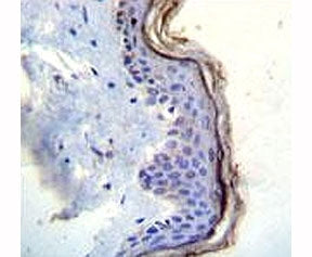 c-Kit antibody immunohistochemistry analysis in formalin fixed and paraffin embedded human skin tiss