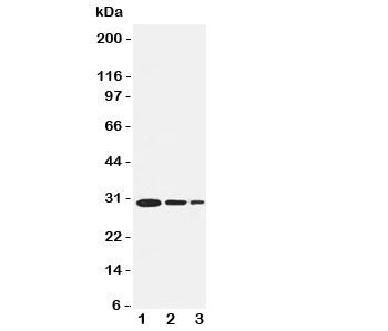 Western blot testing of TRAF1 antbody and recombinant human protein, 30.6KD with tag; Lane 1: 5ng; 2