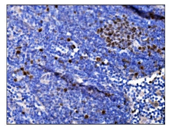 IHC staining of FFPE mouse lymph tissue with Ki67 antibody. HIER: boil tissue sections in pH8 EDTA f