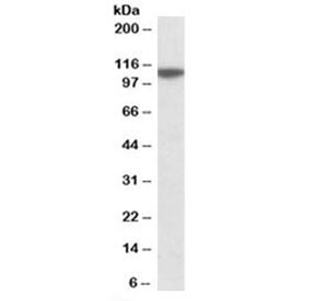 Western blot testing of human cerebellum lysate with MTHFD1L antibody at 0.1ug/ml. Predicted molecul