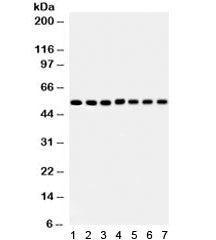 Western blot testing of 1) rat heart, 2) mouse heart, 3) rat skeletal muscle, 4) mouse skeletal musc