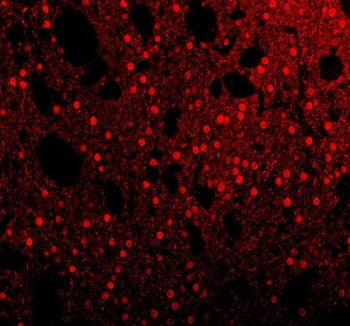 SAM68 Antibody / KHDRBS1
