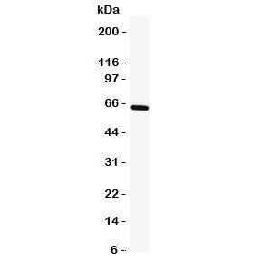 Western blot testing of TRAF5 antibody and human K562 cell lysate. Expected molecular weight ~64 kDa