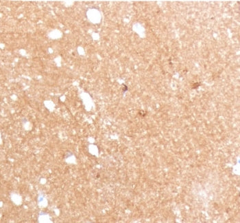 Beta Tubulin Antibody / TUBB3