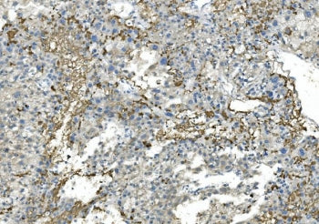 Fibrinogen beta chain Antibody (FGB)