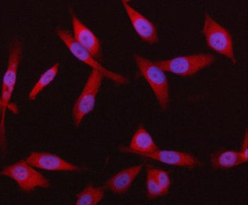 SYVN1 Antibody / Synoviolin / HRD1, 100ug