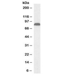 Western blot testing of human pancreas lysate with biotinylated TRPV5 antibody at 1ug/ml. Predicted/
