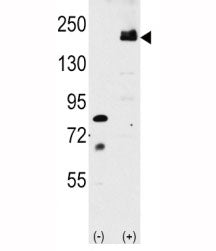 Western blot analysis of LRP6 antibody and 293 cell lysate either nontransfected or transiently tran
