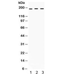 LIF Receptor Antibody / LIFR