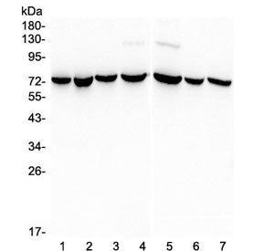 Western blot testing of human 1) HeLa, 2) MBA-MD-231, 3) COLO-320, 4) PANC-1, 5) HT180, 6) MBA-MD-45