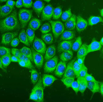 Immunofluorescent staining of FFPE human MCF7 cells with COPE antibody (green) at 5ug/ml and DAPI nuclear stain (blue). HIER: steam section in pH6 citrate buffer for 20 min.