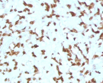 IHC staining of FFPE human liver tissue with Cathepsin D antibody (clone CTPD-1). HIER: boil tissue 
