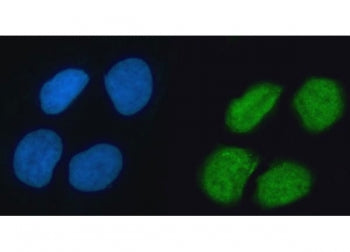 Immunofluorescent staining of FFPE human U-2 OS cells with hnRNP K antibody (green) and DAPI nuclear