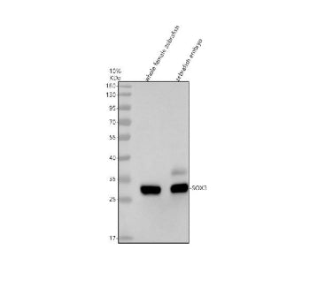 Western blot analysis of Sox3 protein using Zebrafish Sox3 antibody and 1) whole female zebrafish ti