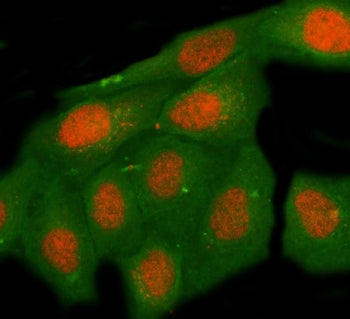 Immunofluorescent staining of FFPE human HeLa cells with Max-binding protein MNT antibody (red) and 