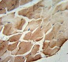 ACOT11 antibody immunohistochemistry analysis in formalin fixed and paraffin embedded human skeletal