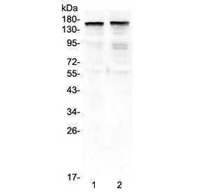 Western blot analysis of 1) rat brain and 2) mouse brain tissue lysates using THBS2 antibody. The ex