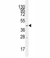 SLC16A1 Antibody