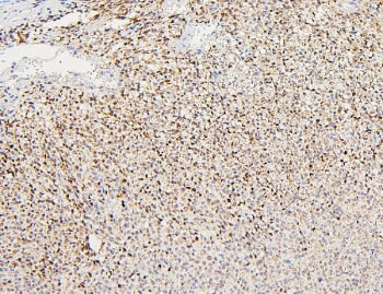 Polycystin 2 Antibody