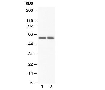 Western blot testing of FMO3 antibody and Lane 1: rat liver; 2: rat liver. Predicted/observed molecu