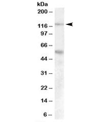 Palladin Antibody
