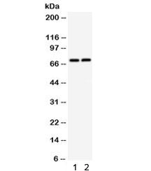 Western blot testing of 1) rat thymus and 2) mouse thymus lysate with TNFRSF1B antibody. Predicted m