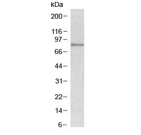 Western blot testing of mouse pancreas with CCKBR antibody at 1ug/ml. Predicted molecular weight ~48