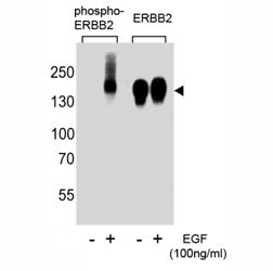 Western blot analysis of extracts from A431 cells, untreated or treated with EGF (100ng/ml), using p