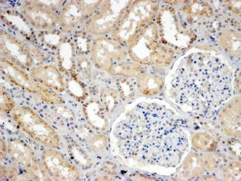 IHC testing of FFPE human kidney with SNX8 antibody at 4ug/ml. HIER: steamed with pH9 Tris/EDTA buff