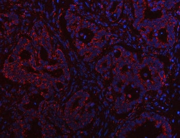 PTPIP51 Antibody / RMDN3