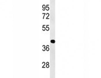Western blot analysis of ATF1 antibody and human Jurkat lysate. Routinely observed molecular weight: