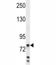 MPO Antibody / Myeloperoxidase, 0.4ml