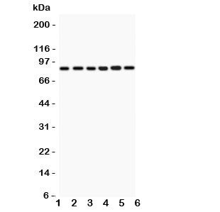 Western blot testing of IKKb antbody and Lane 1: rat heart; 2: (r) skeletal muscle; and human sample