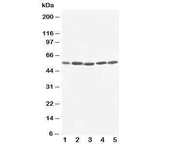 Western blot testing of KIM-1 antibody and human cell lysate 1: SMMC-7721; 2: HeLa; 3: PANC; 4: M231